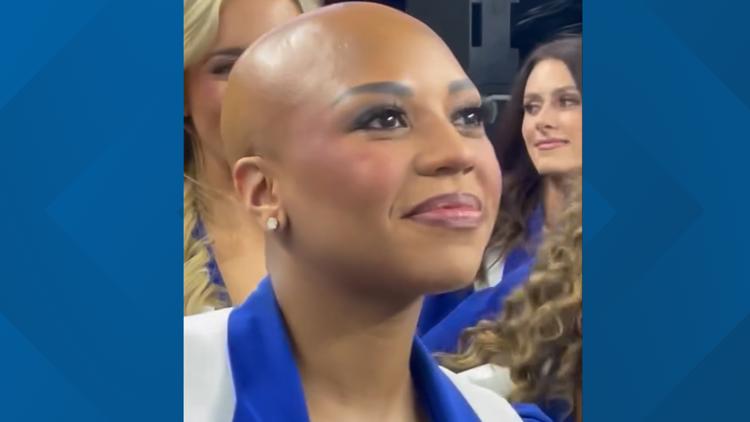 Cowboys cheerleader with alopecia cheers without wig for My Cause My Boots night